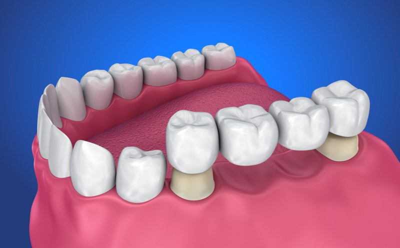 Bond Dental - Advanced Dentistry